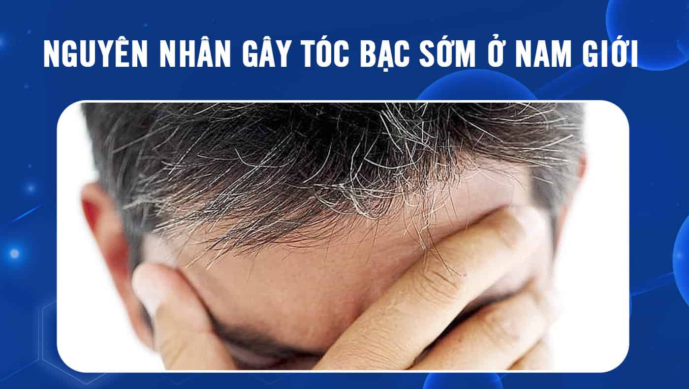 Tóc bạc sớm và tóc bạc muộn